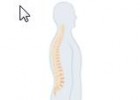 Dolor de espalda | Recurso educativo 45767