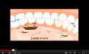 Video: Digestion process | Recurso educativo 77241